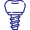 Kanalar dental implants