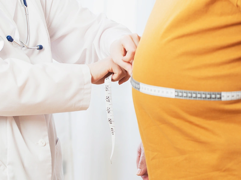 ¿Quiénes son buenos candidatos para la cirugía de bypass gástrico?