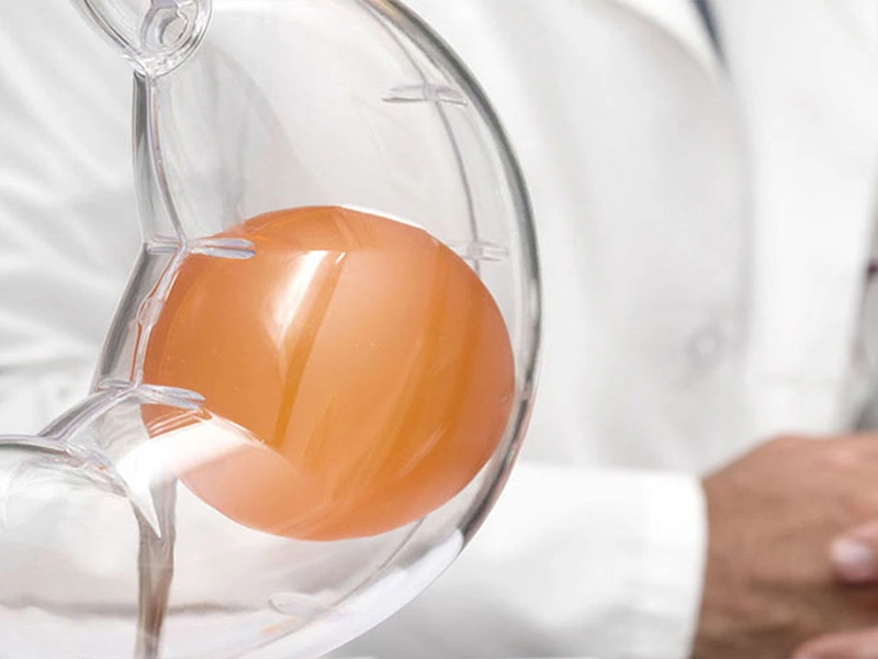 Balón Gástrico: ¿Qué Esperar?