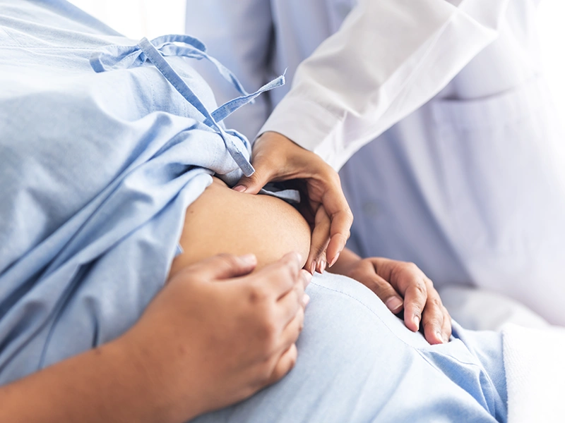 ¿Qué esperar de la cirugía de bypass gástrico?