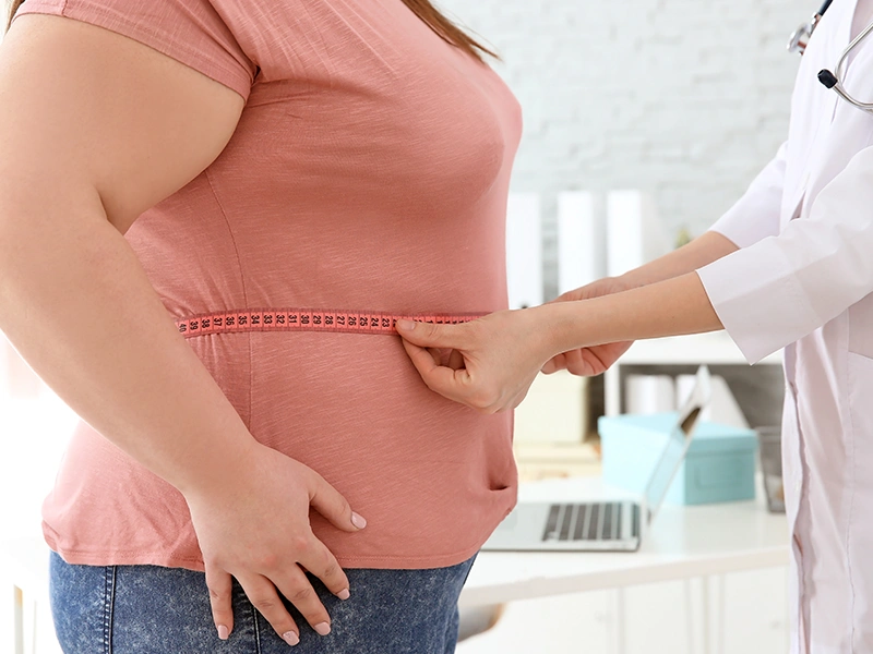 ¿Quiénes son buenos candidatos para la cirugía de manga gástrica?