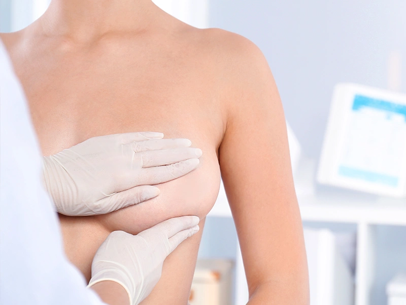 Преимущества операции по подтяжке груди