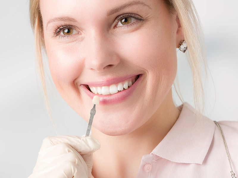 Faccette dentali: cosa aspettarsi?