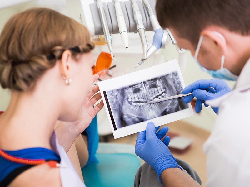 Implantes dentales: ¿qué esperar?