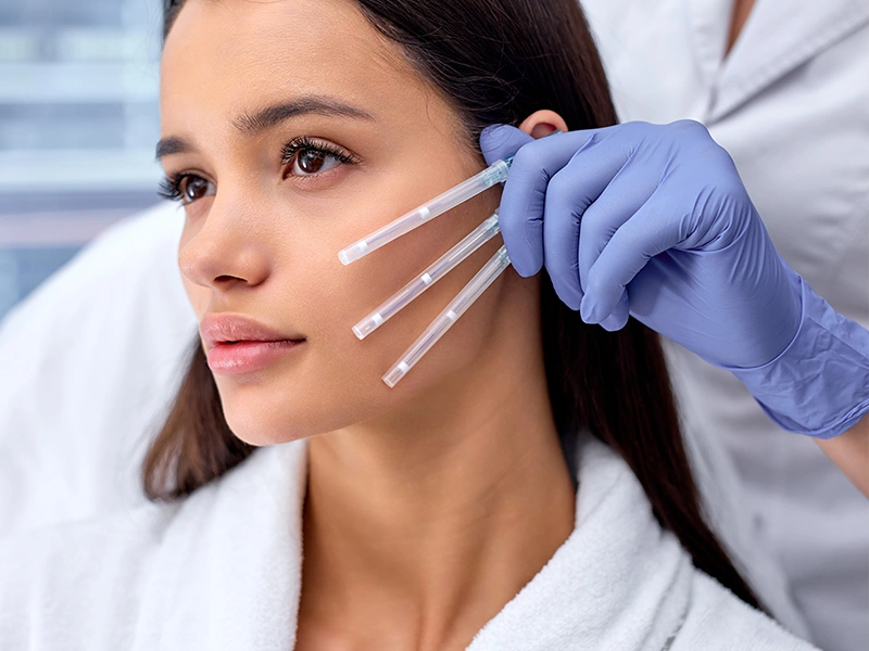 Beneficios de la cirugía de estiramiento facial