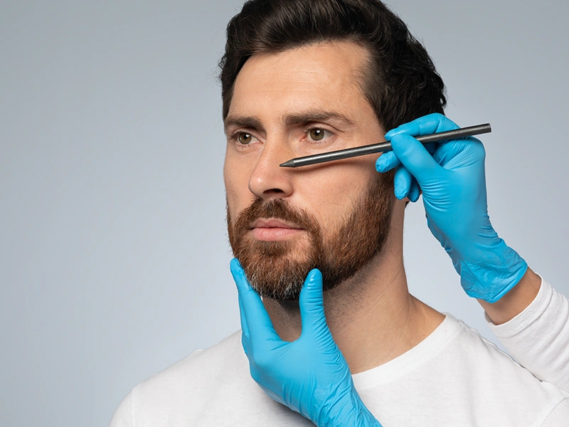 Преимущества ринопластики