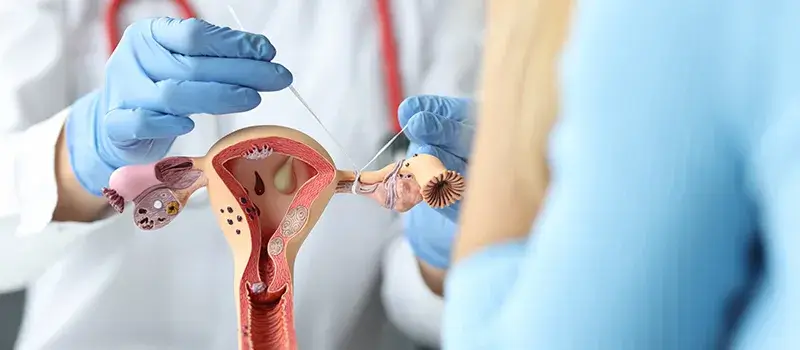 gynecology.operation-expect