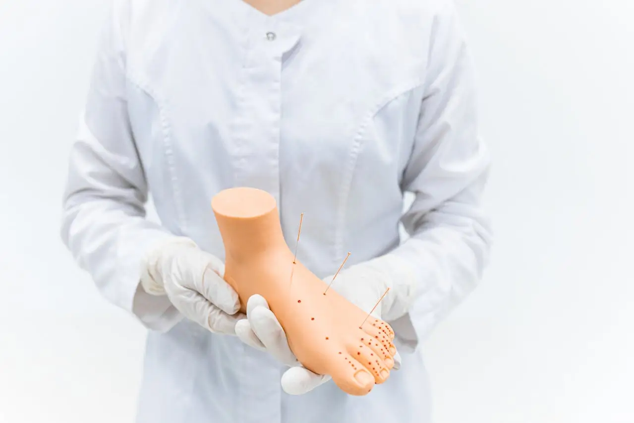 ¿Qué es la artrodesis (fusión articular)?