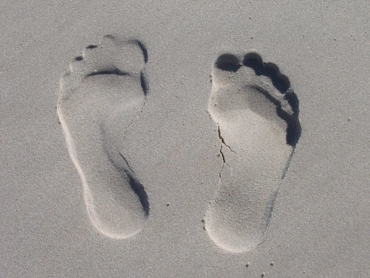 What causes flat feet?