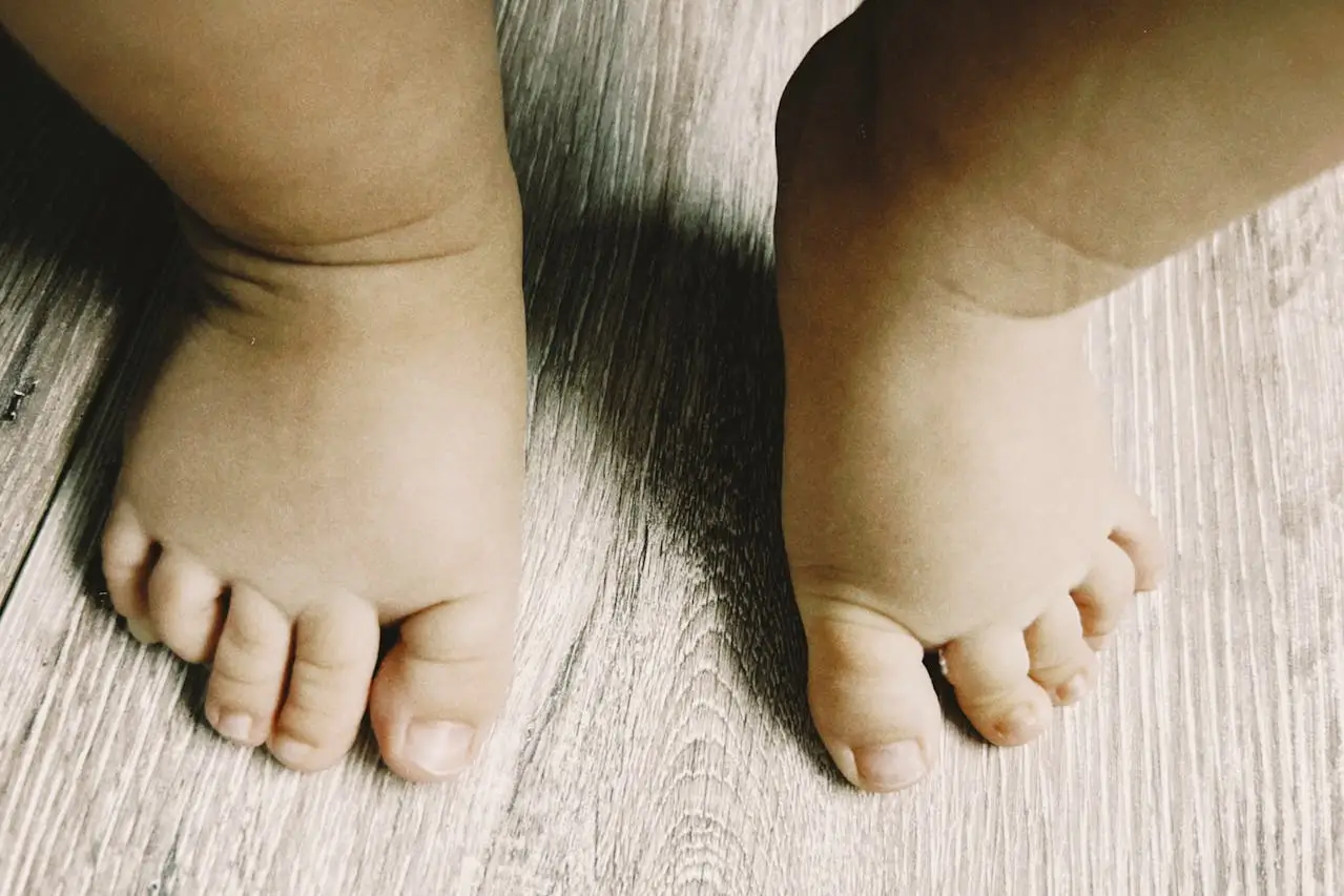 What is flatfoot?