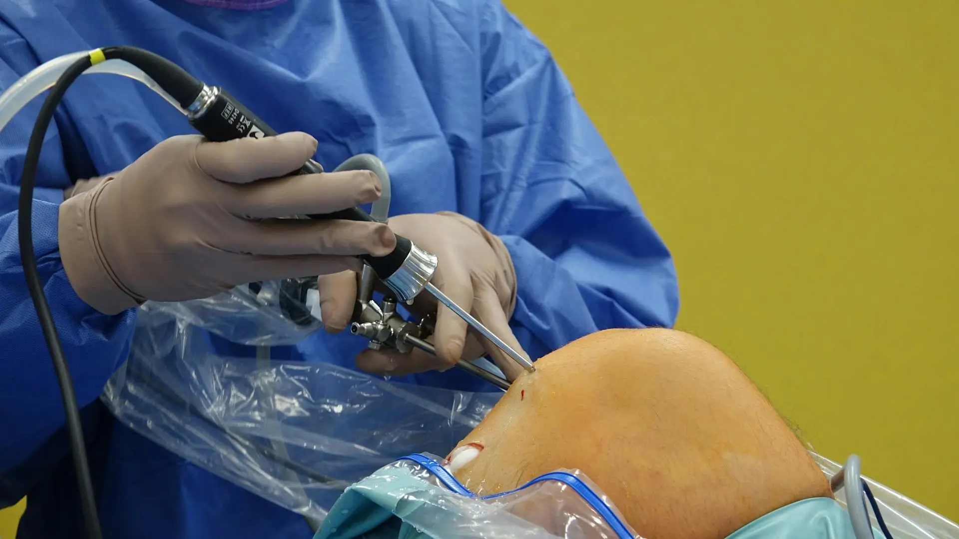 kneeprosthesis.operation-benefits