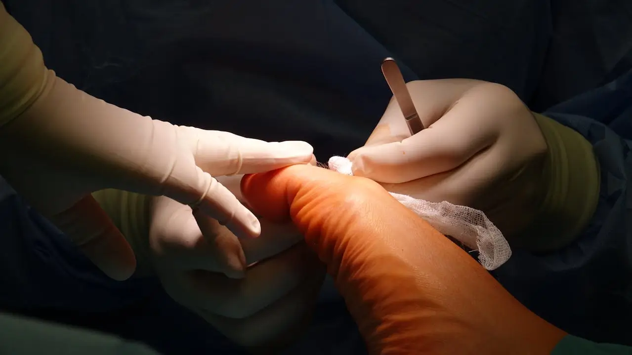 Surgical Treatment: How Is Ligament Reconstruction Performed?